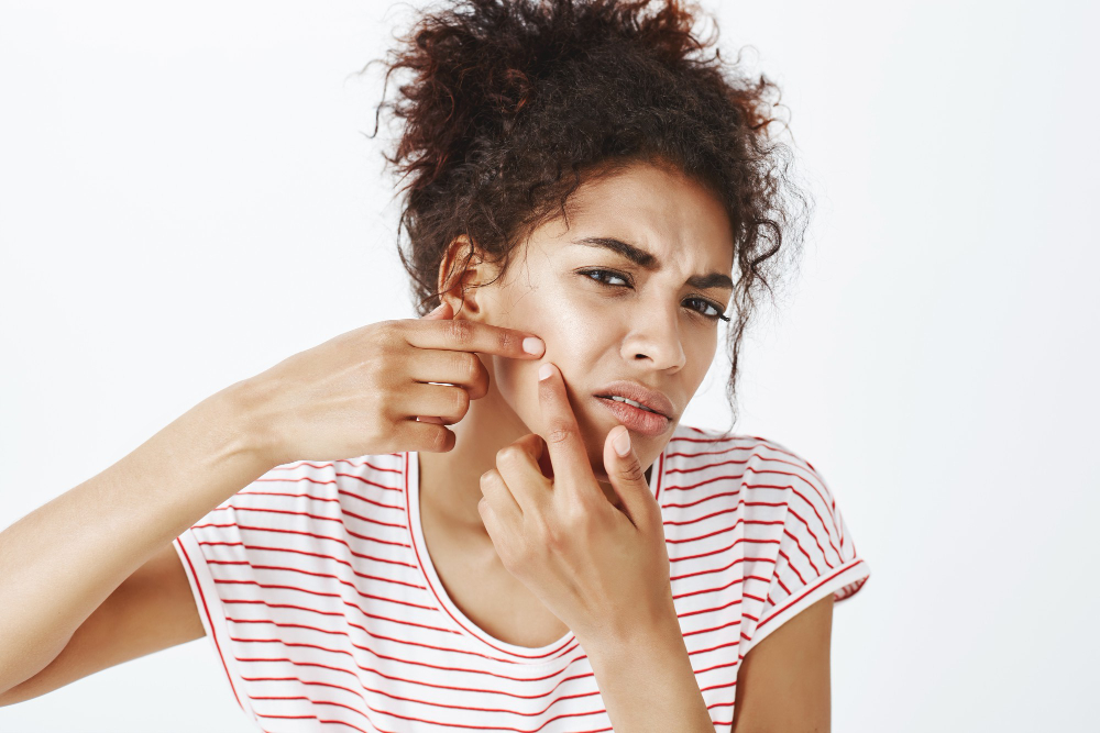 black women checking her face acne